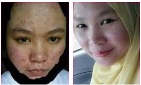 testimoni 2 sebelum dan selepas gunakan sabun collagen